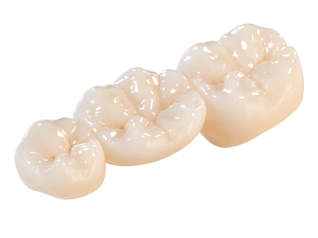 Zirconia Crowns